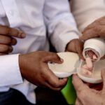 HIV and AIDS
