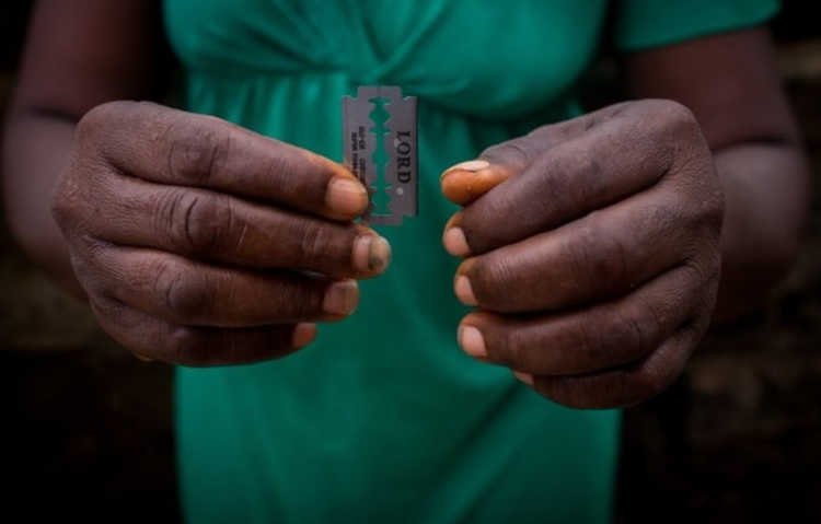 FGM